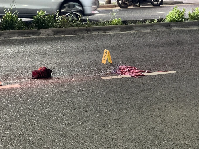 9-year-old in critical condition after Hulhumalé road accident